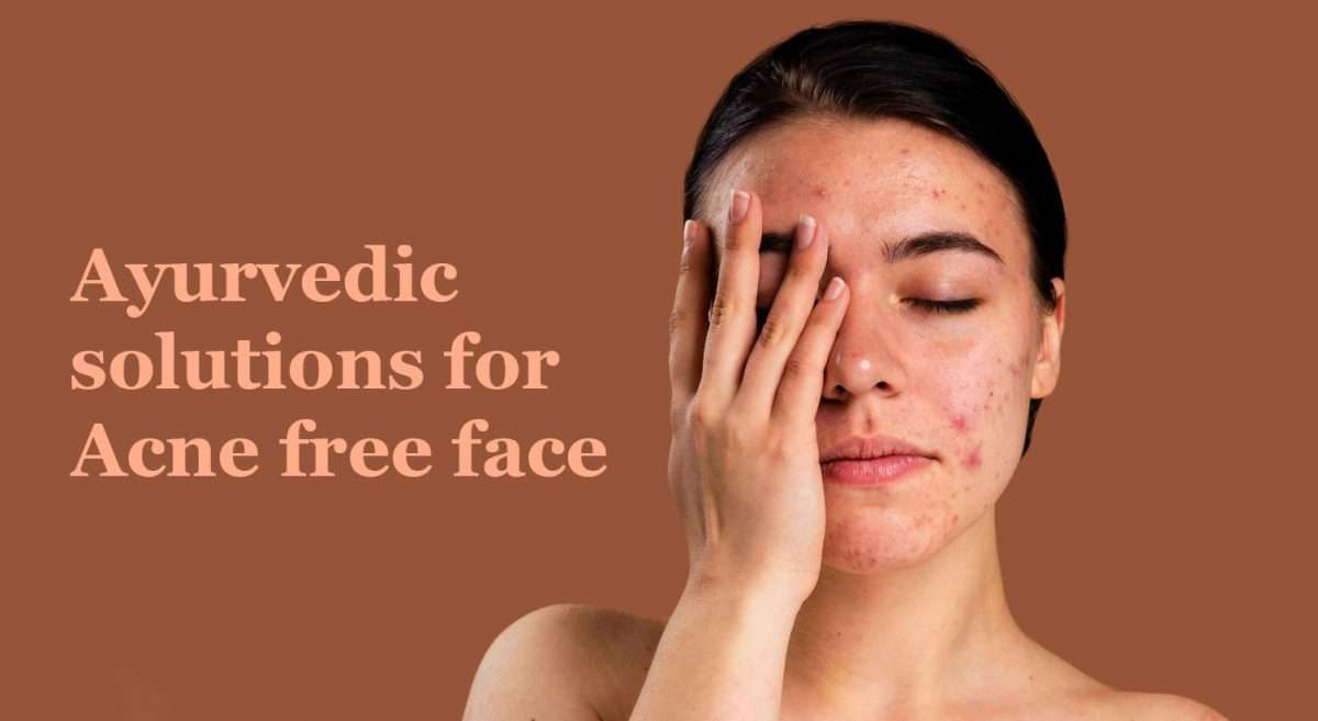 Ayurvedic-solutions-for-Acne-free-face-1200x657.jpg
