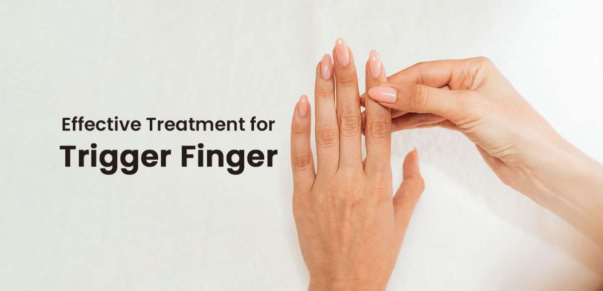 Effective-Treatment-for-Trigger-Finger-1200x580.jpg