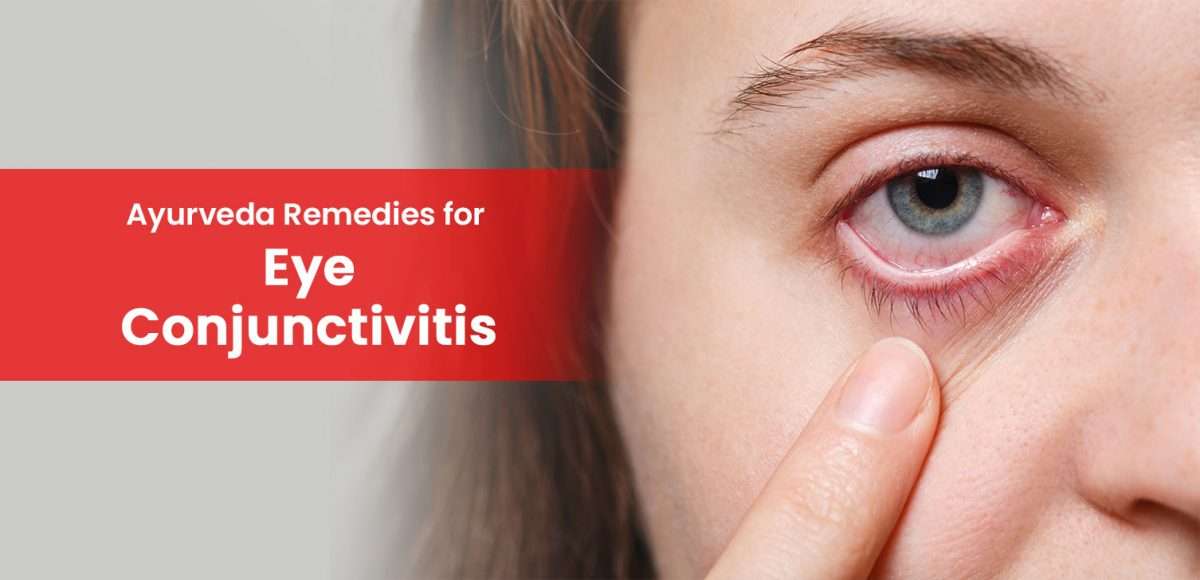 Ayurveda-Remedies-for-Eye-Conjunctivitis-1200x580.jpg