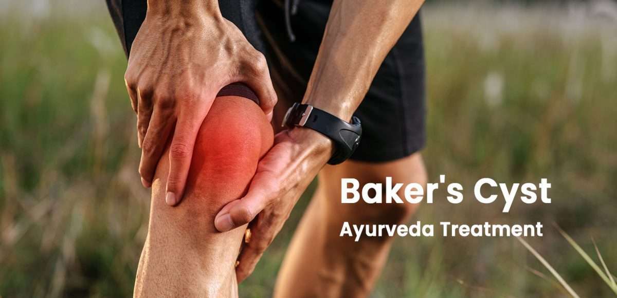Bakers-Cyst-Ayurveda-Treatment-1200x580.jpg