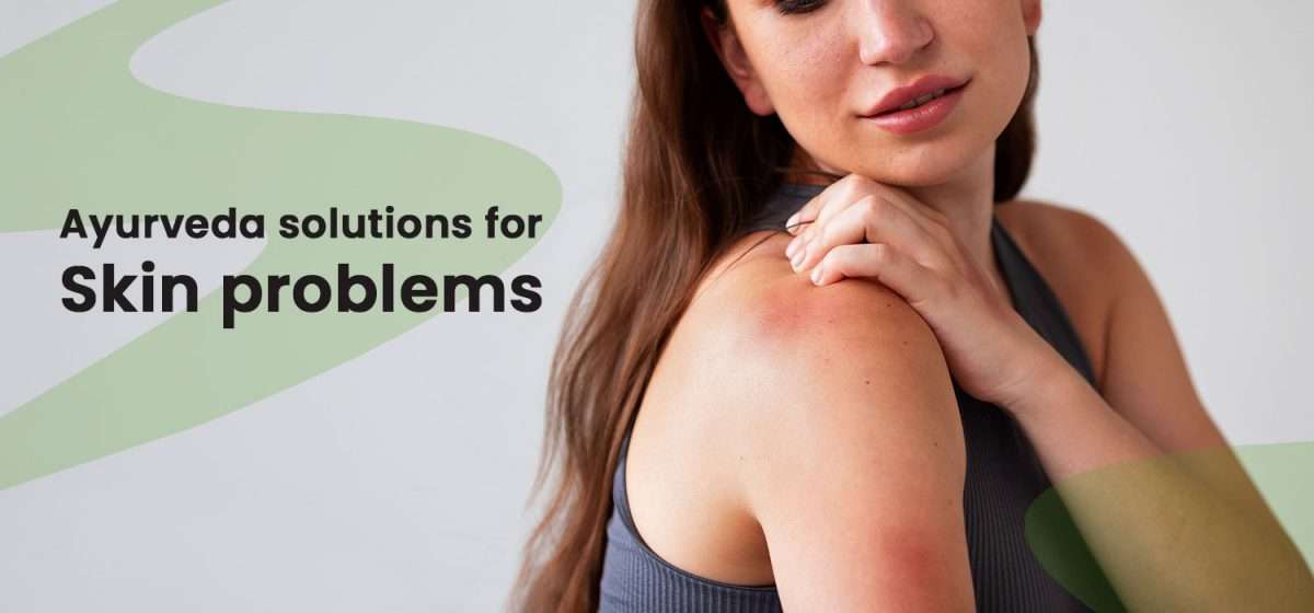 Ayurveda-solutions-for-Skin-problems-1200x560.jpg