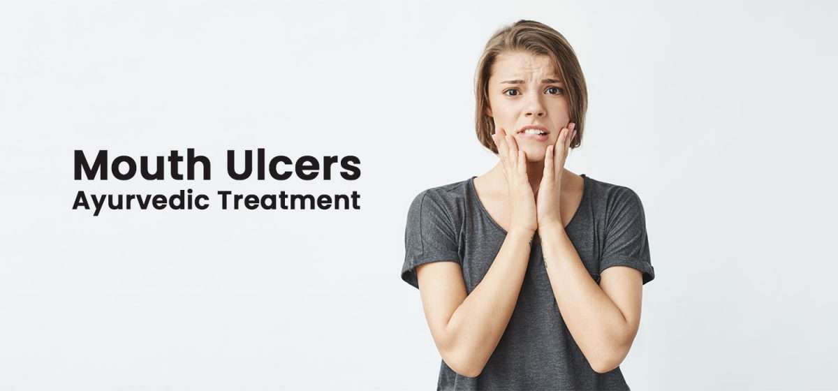 Mouth-Ulcers-Ayurvedic-Treatment-1200x560.jpg