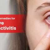 conjunctivitis-ayurveda-treatment-melbourne