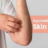 skin-rash-ayurveda-traetment