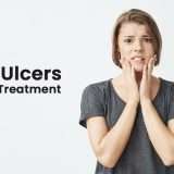 mouth-ulcers-ayurvedic treatment